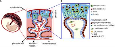 Vertical Zika Virus Transmission at the Maternal-Fetal Interface
